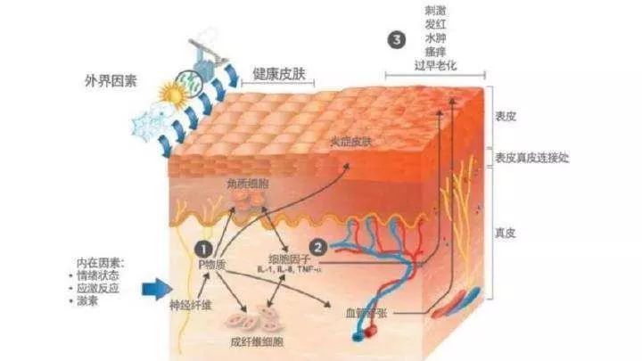 慶陽市“屏障修復”修復的是什么？不同膚質該如何搭配？